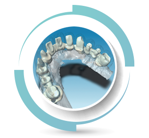 STRUTTURE per RIABILITAZIONI COMPLESSE STRUTTURE per RIABILITAZIONI COMPLESSE